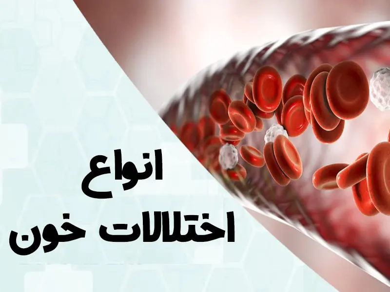 معرفی انواع بیماری های خونی و اختلالات خونی