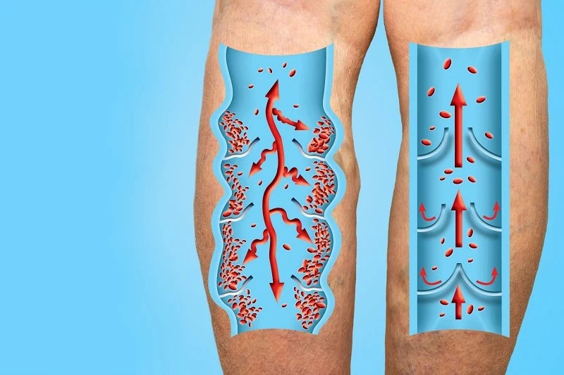 چگونه می‌توانیم غلظت خون را تشخیص دهیم؟