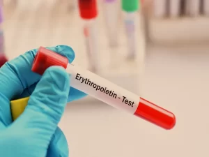 آزمایش EPO چیست