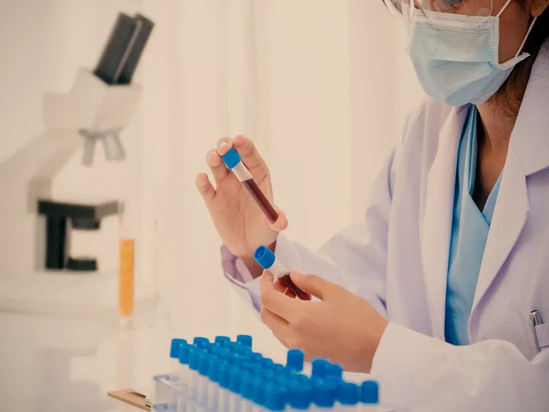 تشخیص سطح EPO در بدن