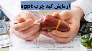 آزمایش کبد چرب sgpt