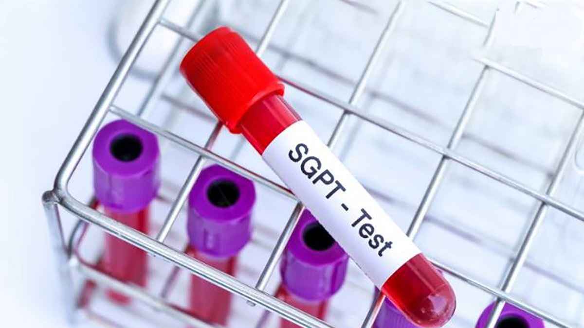 ارتباط آزمایش SGPT و کبد چرب