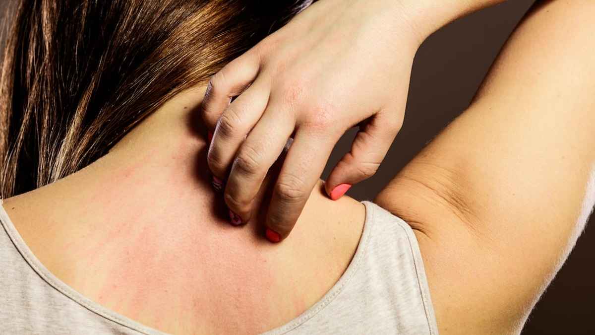 ارتباط میان خون‌رسانی و سلامت پوست