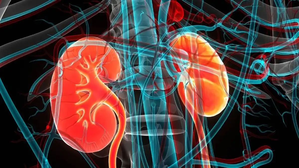 تأثیر آنمی بر سنگ کلیه و سایر اختلالات کلیوی
