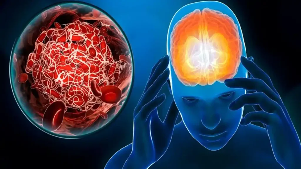 تاثیر هموکروماتوز بر عملکرد مغز