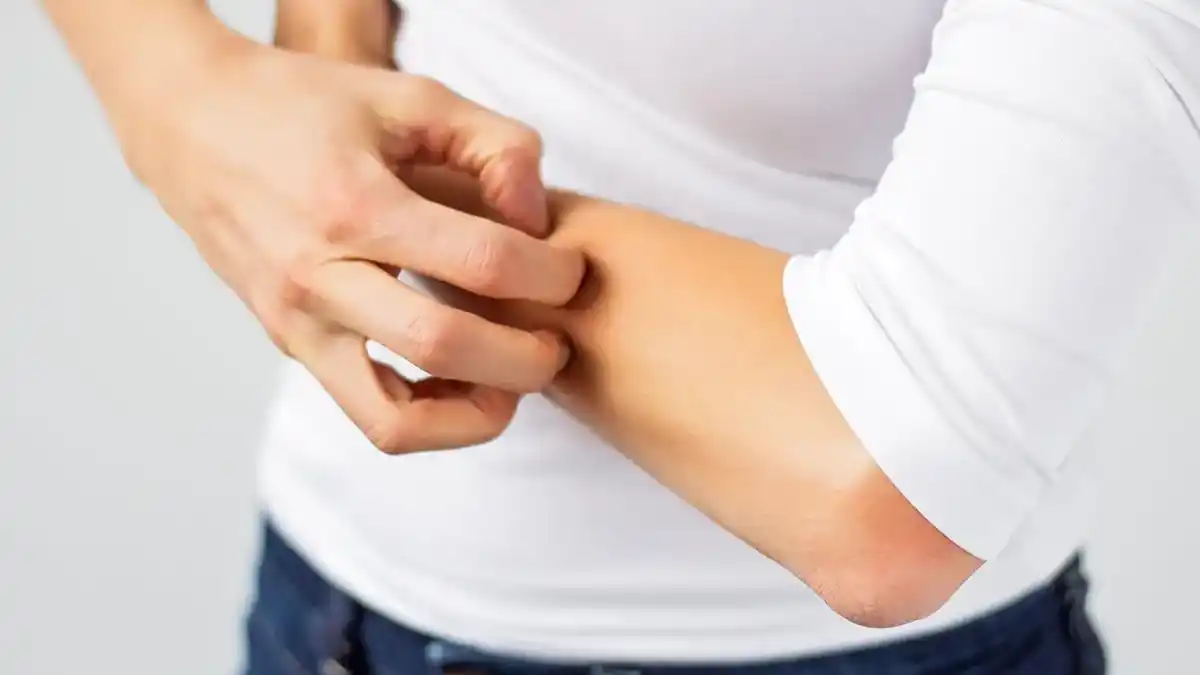 مهم‌ترین نشانه‌های پوستی کم‌خونی