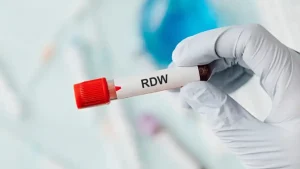 RDW آزمایش خون