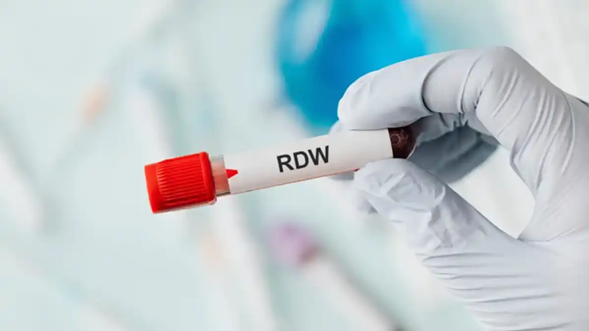 RDW آزمایش خون