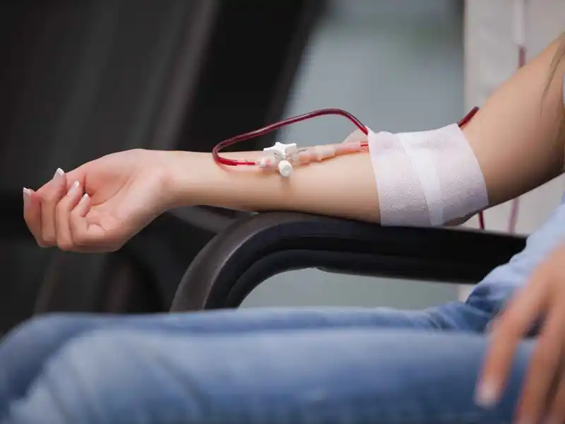 بهترین مراکز برای فصد خون در دروس چه ویژگی‌هایی دارند؟